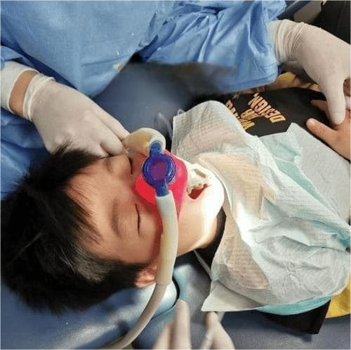 Medical nitrous oxide assisted tooth treatment